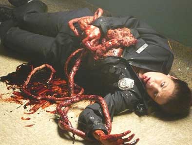 Police officer with intestines removed