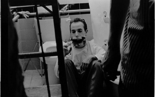 Man missing his lower jaw sits on a bathroom floor