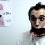 Man discovers his lower jaw has fallen off