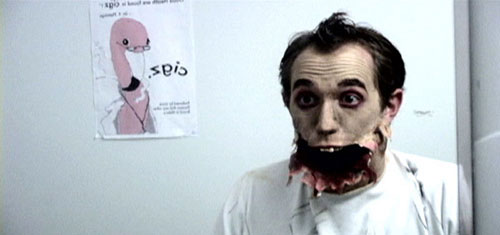 Man discovers his lower jaw has fallen off