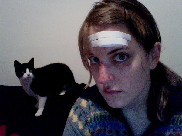 A bruised Lori Felker stares into the camera while her black and white cat stares at her