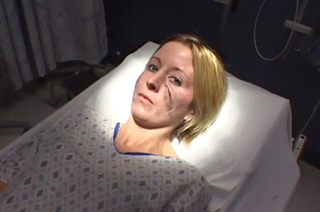 Bethlehem Woman with a scarred face lying on a hospital bed