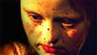 Person with Down Syndrome